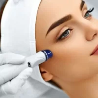 انواع میکرودرم ابریژن